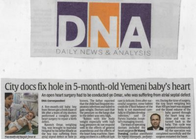 Dr. Manoj Durairaj fix hole in 5 moth old Yemeni baby's Heart